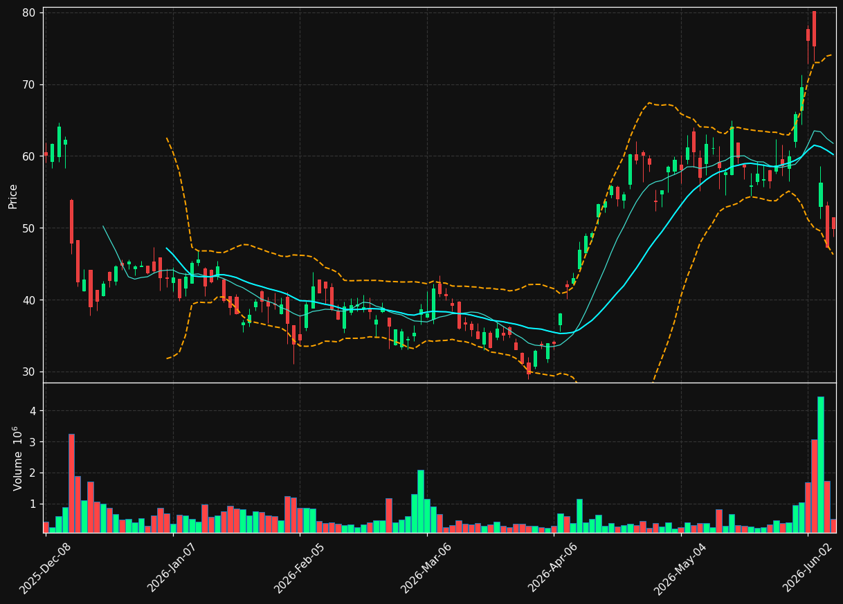 AVL chart
