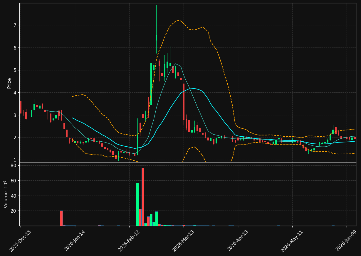 CDIO chart