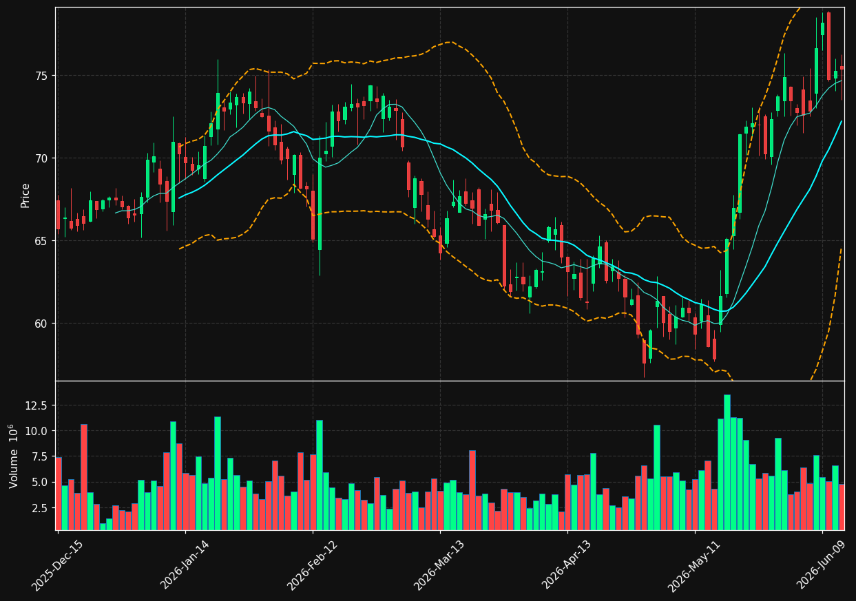 DXCM chart