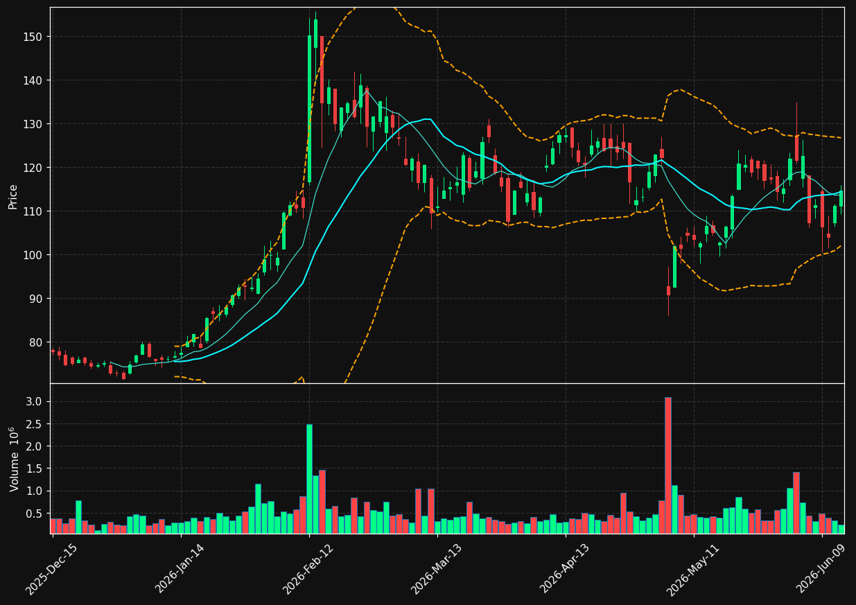 IPGP chart