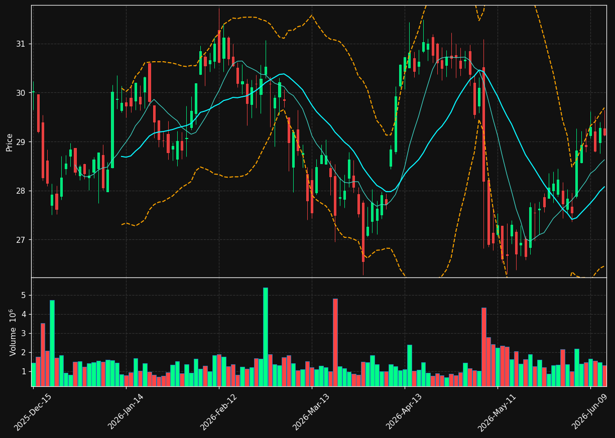 MRP chart