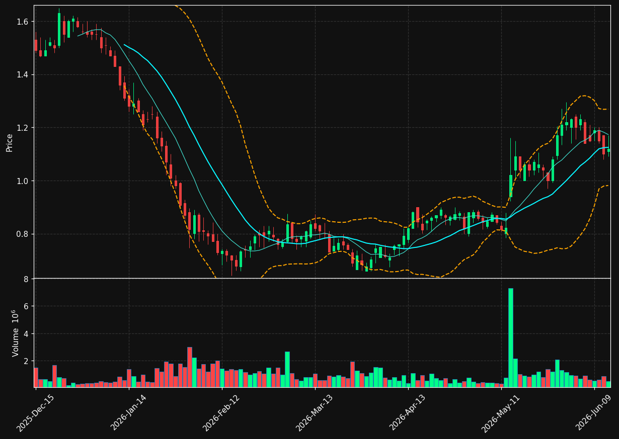 MXCT chart